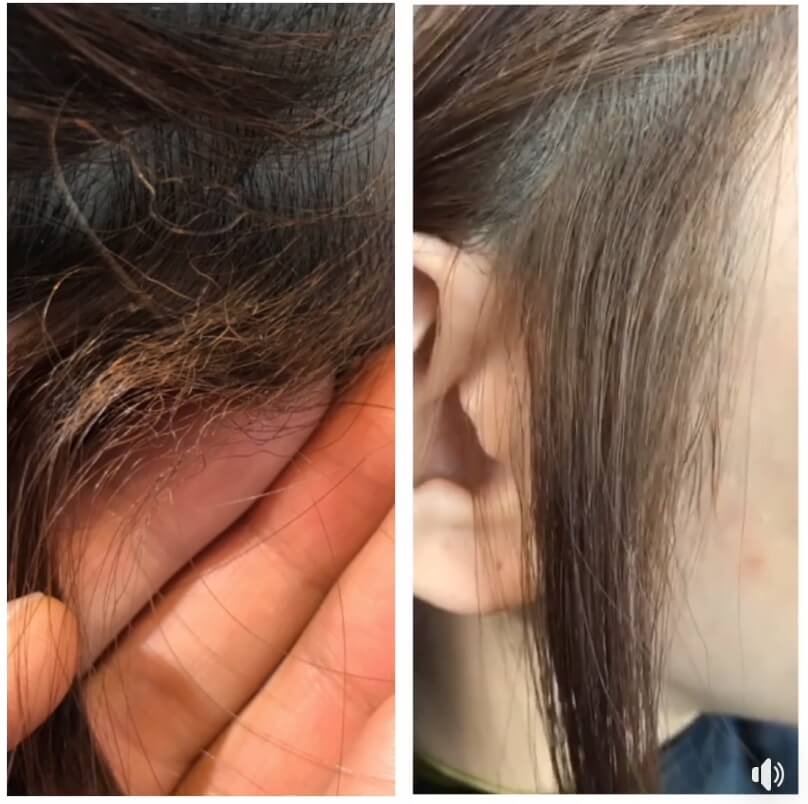 ビビリ毛を直せる技術があります。